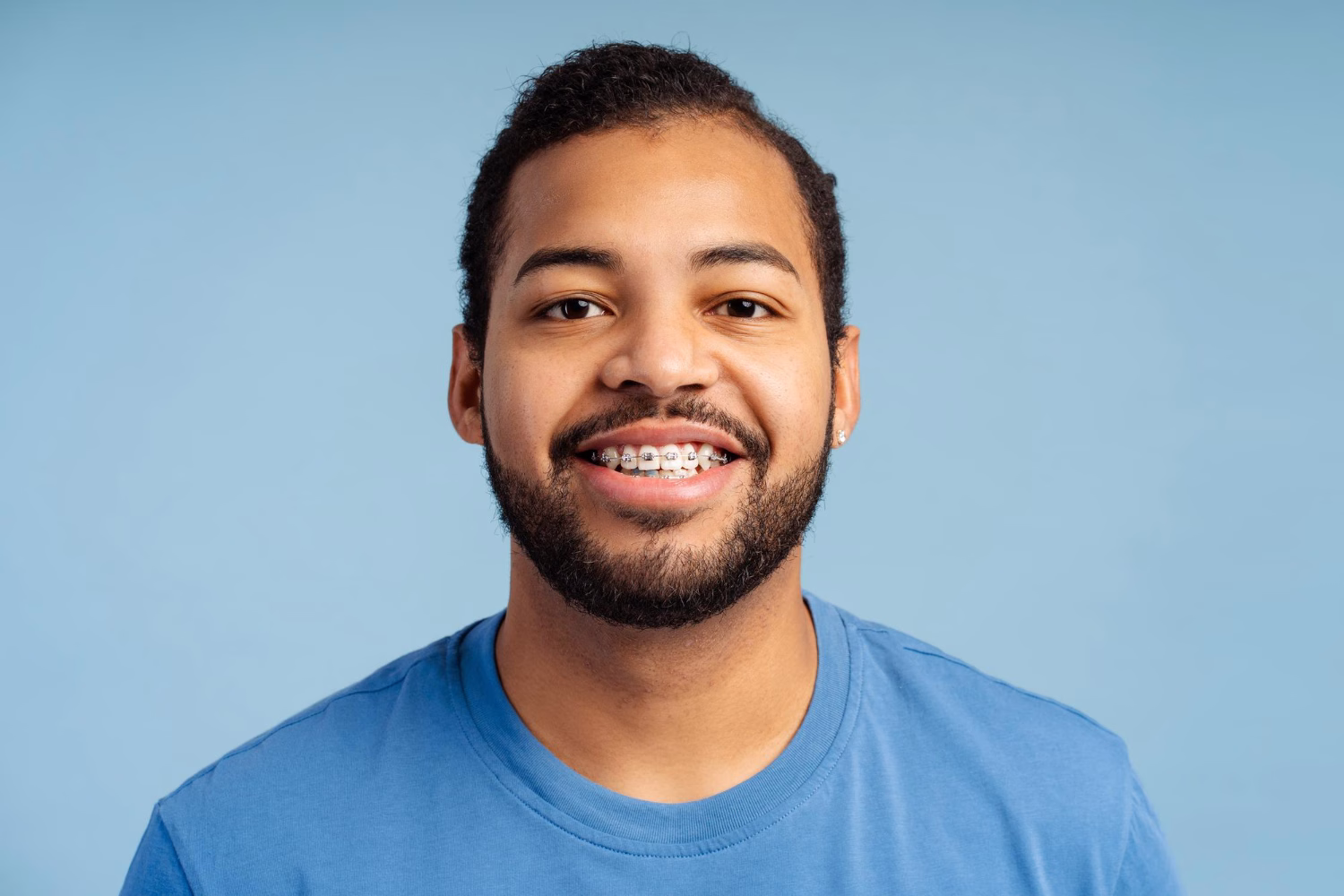 Adult Orthodontics