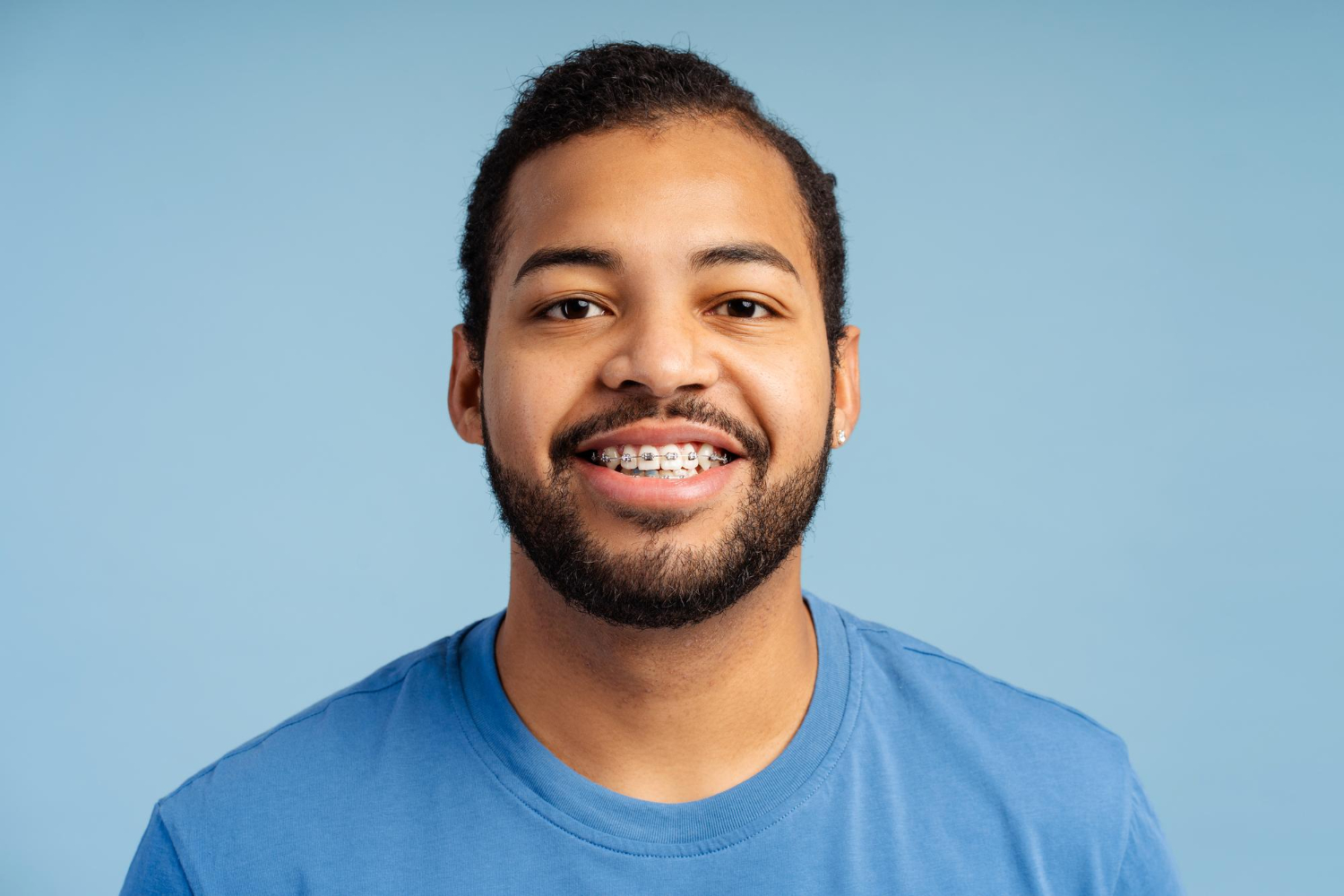 Adult Orthodontics