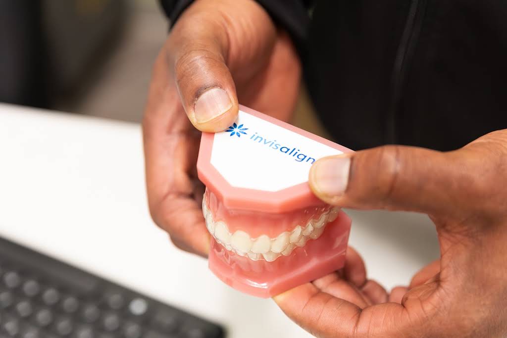 Invisalign Clear Aligners